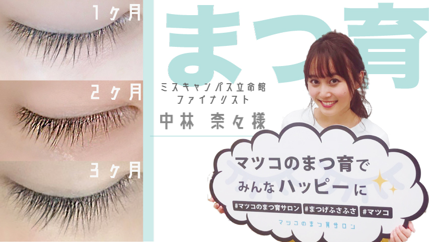 ミスキャンパス立命館ファイナリスト 中林奈々様 まつ育サロン体験インタビュー